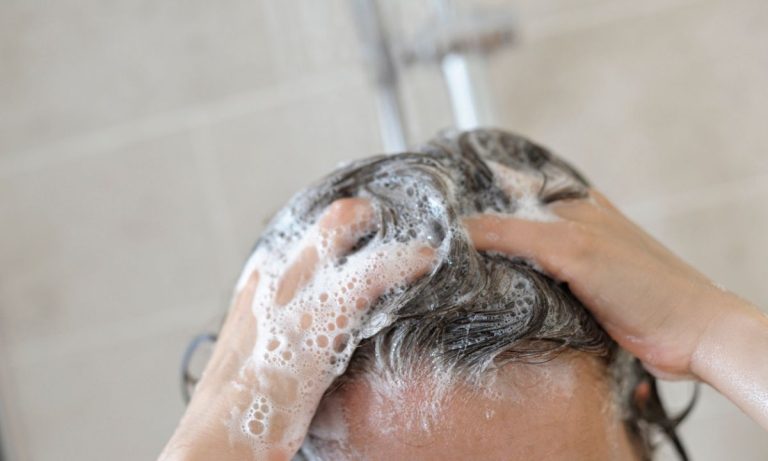 7 Rekomendasi Shampo Anti Ketombe Terbaik yang Paling Ampuh